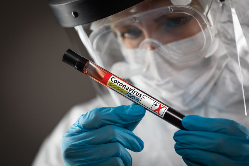 Lab Worker Holds Test Tube of Blood Labeled Coronavirus COVID-19 Disease.